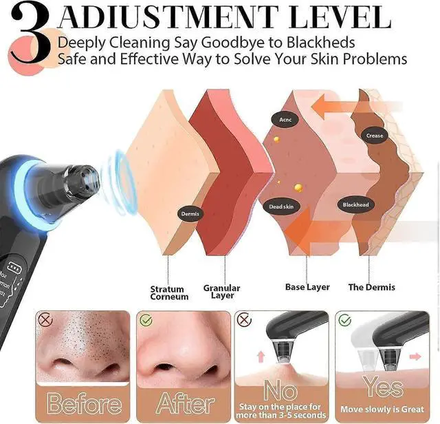 Alt view image 2 of 5 - Ecocleanpath Upgraded Blackhead Remover Pore Vacuum with Blue Light, 4 Probes & 3 Modes - Electric Facial Cleaner Tool for Women & Men - White