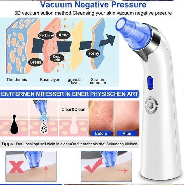 Alt view image 5 of 5 - Ecocleanpath Electric Blackhead Remover Vacuum, 5-Level Suction & 4 Probes for Deep Pore Cleaning - Rechargeable USB