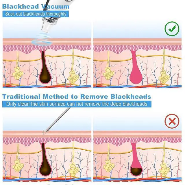 Alt view image 3 of 5 - Ecocleanpath USB Rechargeable Blackhead Remover Vacuum - 5-Level Pore Cleaner with LED Display, White