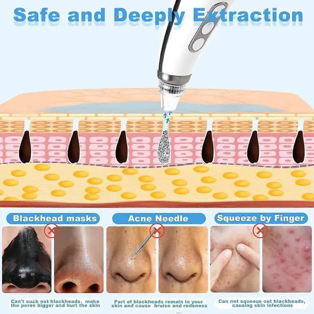 Alt view image 4 of 5 - Ecocleanpath USB Rechargeable Blackhead Remover Vacuum - 5-Level Pore Cleaner with LED Display, White