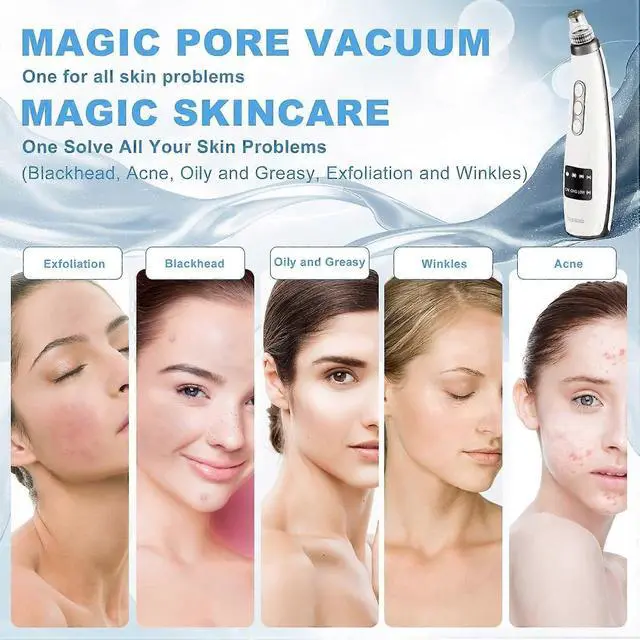 Alt view image 5 of 5 - Ecocleanpath USB Rechargeable Blackhead Remover Vacuum - 5-Level Pore Cleaner with LED Display, White