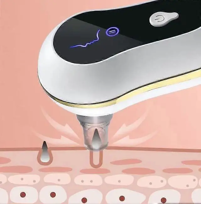 Alt view image 2 of 5 - Ecocleanpath Electric Blackhead Remover & Pore Cleaner - 3-Level Suction, LED Display, 300 Min Use, For All Skin Types