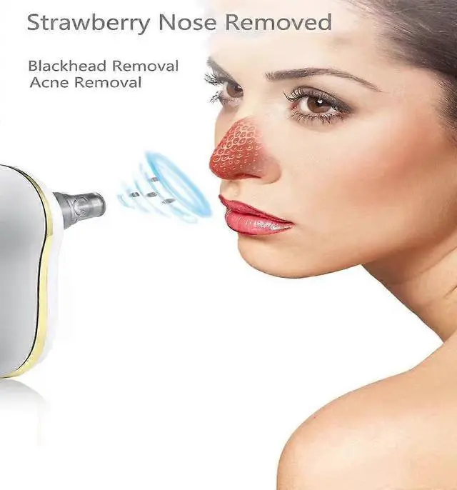 Alt view image 5 of 5 - Ecocleanpath Electric Blackhead Remover & Pore Cleaner - 3-Level Suction, LED Display, 300 Min Use, For All Skin Types