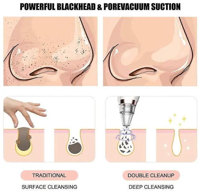 Alt view image 5 of 5 - Ecocleanpath Upgraded Pore Vacuum Cleaner: Strong Suction Blackhead Remover, 6 Tips, USB Rechargeable, White