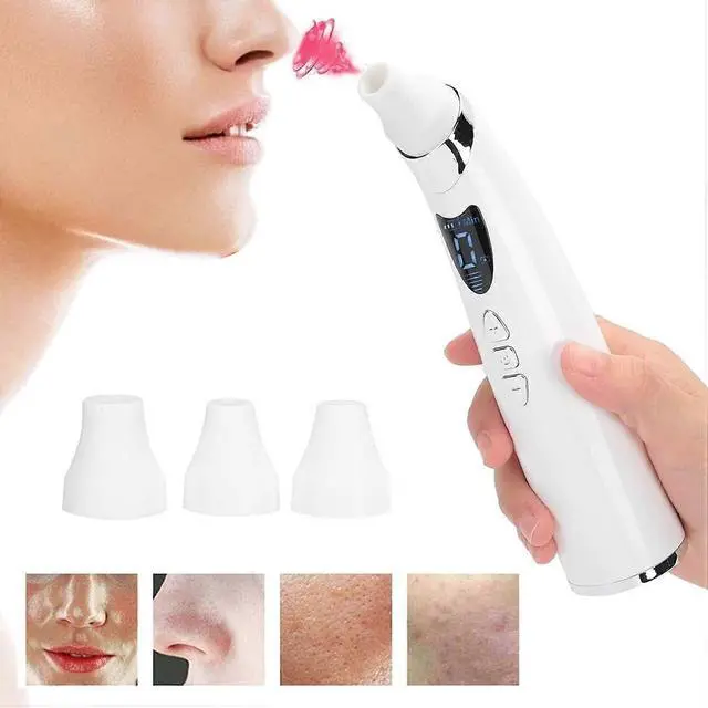 Alt view image 2 of 5 - Ecocleanpath Visual Blackhead Remover Vacuum with Camera, 5 Speeds & 4 Heads for Pore Cleaning (White)