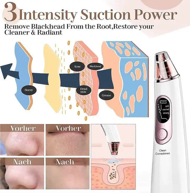 Alt view image 2 of 5 - Ecocleanpath Electric Blackhead Remover Pore Vacuum: 4 Probes, 3 Suction Modes, Rechargeable (White)