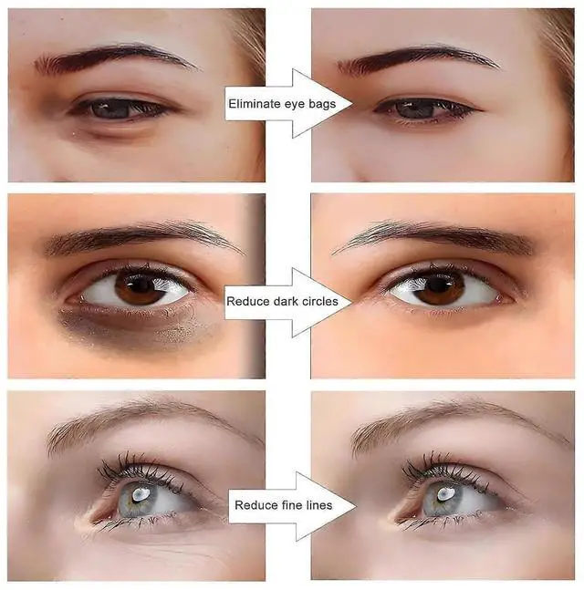 Alt view image 4 of 5 - Ecocleanpath Red Light Therapy Glasses with Microcurrent - 3D Eye Massager for Dark Circles, Puffiness & Wrinkles Relief