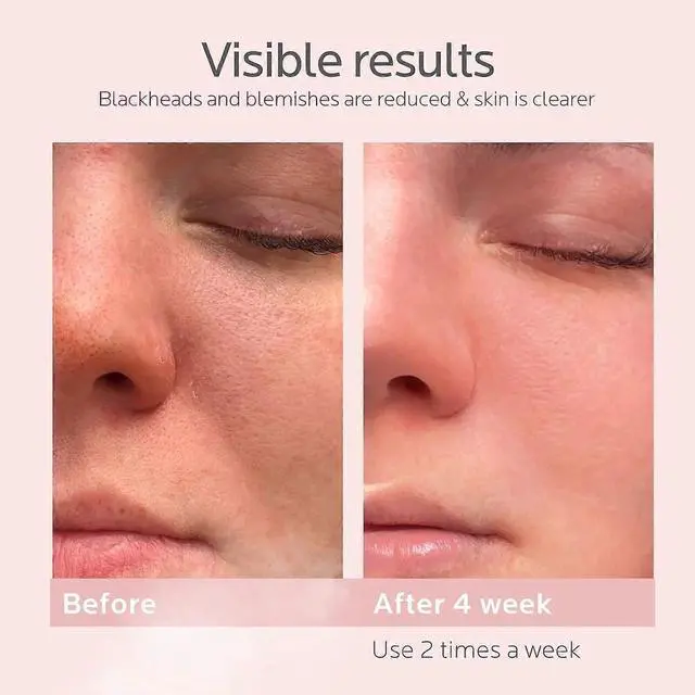 Alt view image 2 of 5 - Ecocleanpath Purple Nano Ion Facial Steamer - Deep Pore Cleansing & Moisturizing for All Skin Types