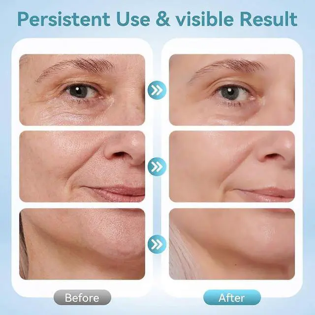 Alt view image 5 of 5 - Ecocleanpath 45C Heated Anti-Wrinkle Facial Massager - 7 LED Colors, 3 Modes, EMS Microcurrent for Skin Firming (White)