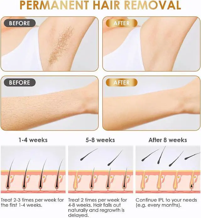 Alt view image 3 of 6 - Home Use Beauty Device Hair Removal for Women and Men,999999 Flashes at-Home Hair Removal Device (S)