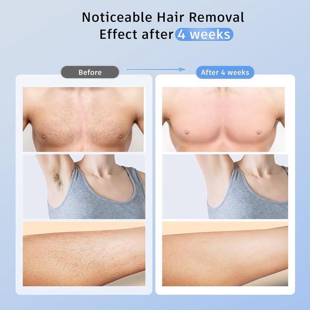 Alt view image 7 of 7 - Laser Hair Removal with 5 Ice Cooling, Painless IPL Laser Hair Removal Device 3 In 1 Ubroo At Home Hair Remover Machine for Women Men Electrolysis Permanent Epilator on Face Body Depilation (Purple)