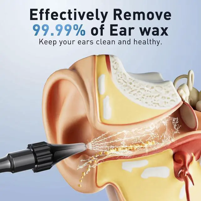 Alt view image 3 of 7 - Ear Wax Removal - Electric Ear Irrigation Flushing System with 4 Pressure Modes, Ear Cleaner with Camera, 1080P Otoscope, Ear Cleaning Tool with 7 Pcs Ear Set, Safe and Effective Earwax Removal Kit
