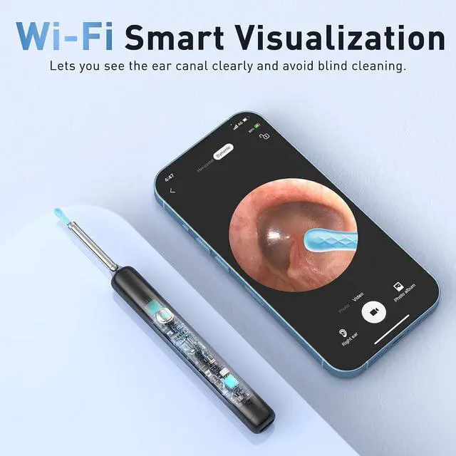 Alt view image 7 of 7 - Ear Wax Removal - Electric Ear Irrigation Flushing System with 4 Pressure Modes, Ear Cleaner with Camera, 1080P Otoscope, Ear Cleaning Tool with 7 Pcs Ear Set, Safe and Effective Earwax Removal Kit