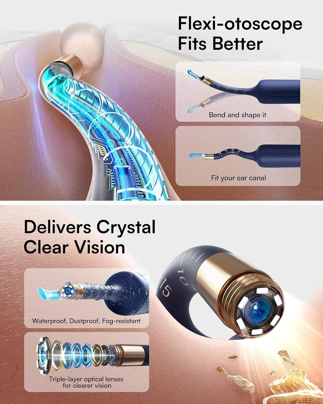 Alt view image 2 of 7 - R37R Ear Wax Removal Tool Camera, Flexible Scope and Visual Tweezers