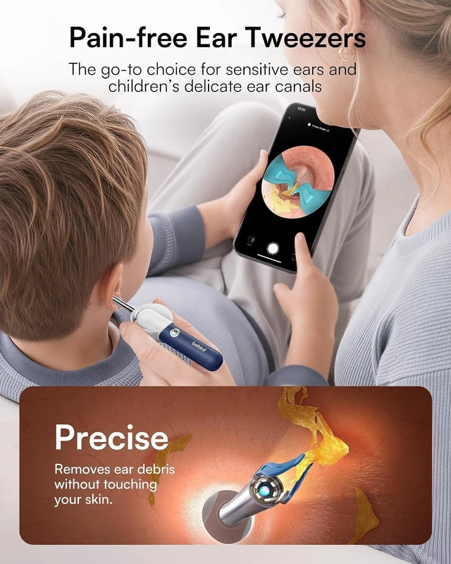 Alt view image 3 of 7 - R37R Ear Wax Removal Tool Camera, Flexible Scope and Visual Tweezers