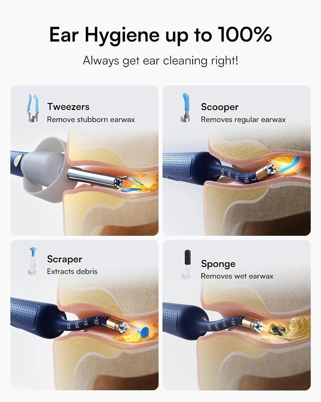 Alt view image 4 of 7 - R37R Ear Wax Removal Tool Camera, Flexible Scope and Visual Tweezers