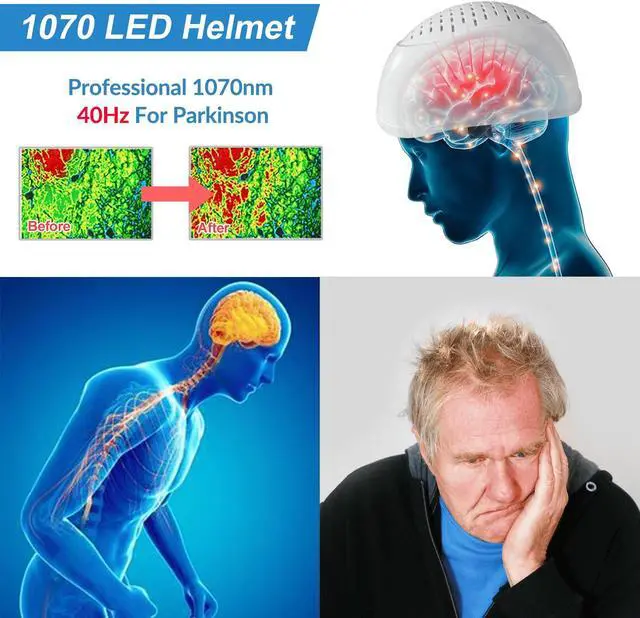 Alt view image 6 of 7 - ZJZK Parkinson'S Depression Treatment 810Nm*280Diodes*60Mw  Red Light Therapy  Dementia Helmet Brain Health Portable Home Use