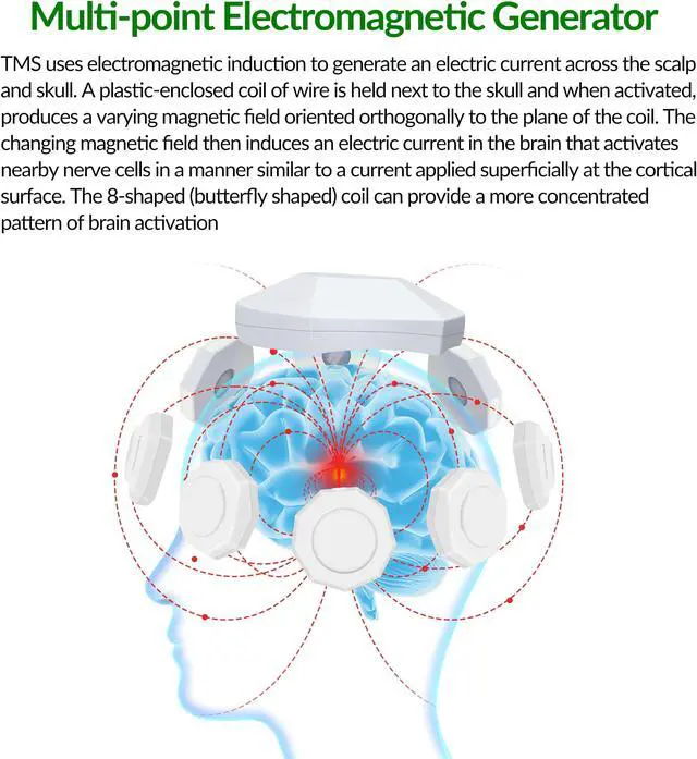 Alt view image 3 of 7 - ZJZK Tms Treatment For Depression Brain Stimulation Device For Major Depressive Disorder Mdd Neuropathic Pain Migraine
