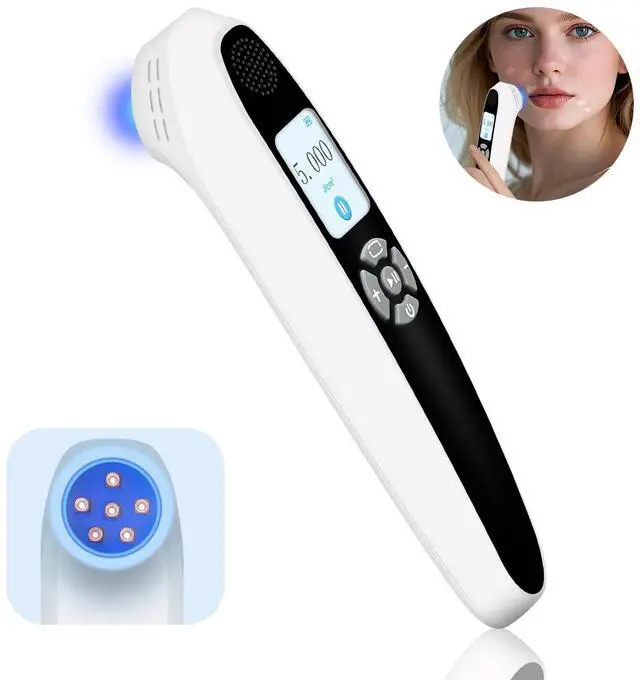 Main image of ZJZK 308nm UVB Handheld Light Therapy Lamp High Intensity, High Targeting Phototherapy for Skin white Use for Vitiligo and Psoriasis
