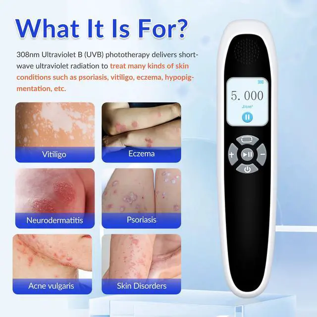 Alt view image 5 of 7 - ZJZK 308nm UVB Handheld Light Therapy Lamp High Intensity, High Targeting Phototherapy for Skin white Use for Vitiligo and Psoriasis 45mW/cm2