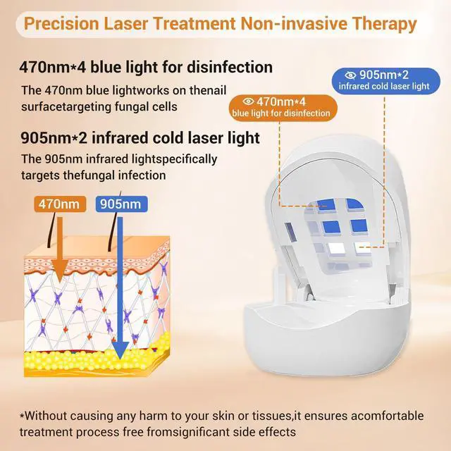 Alt view image 2 of 7 - ZJZK Nail Fungus Light for Toenails, Highly Effective Blue Light to Defeat Onychomycosis, Revolutionary Nail Fungus Solution Easy to Use at Home, Elderly