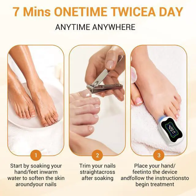 Alt view image 6 of 7 - ZJZK Nail Fungus Light for Toenails, Highly Effective Blue Light to Defeat Onychomycosis, Revolutionary Nail Fungus Solution Easy to Use at Home, Elderly