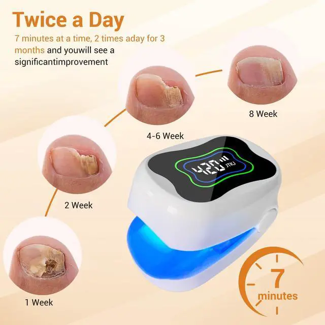 Alt view image 3 of 7 - ZJZK Nail Fungus Light for Toenails, Highly Effective Blue Light to Defeat Onychomycosis, Revolutionary Nail Fungus Solution Easy to Use at Home, Elderly