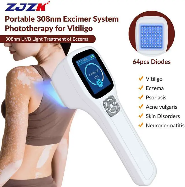 Main image of ZJZK 308nm wavelength UVB portable handheld Lamp device, suitable for home use, safe and efficient for vitiligo psoriasis