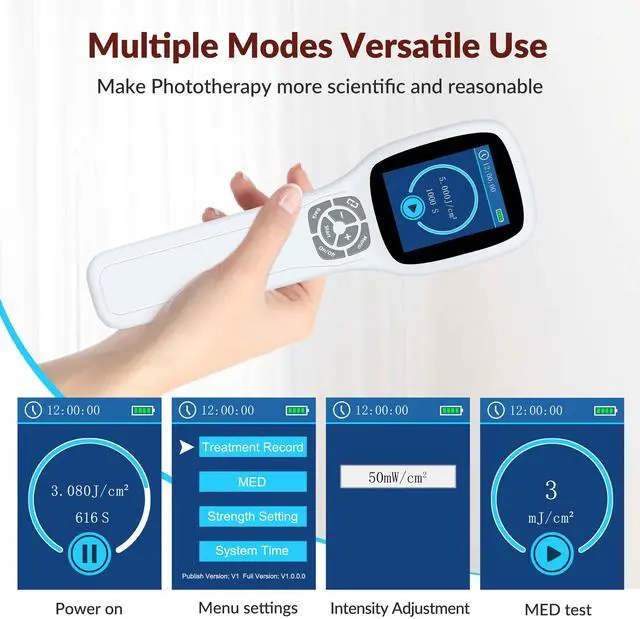Alt view image 5 of 7 - ZJZK 308nm wavelength UVB portable handheld Lamp device, suitable for home use, safe and efficient for vitiligo psoriasis