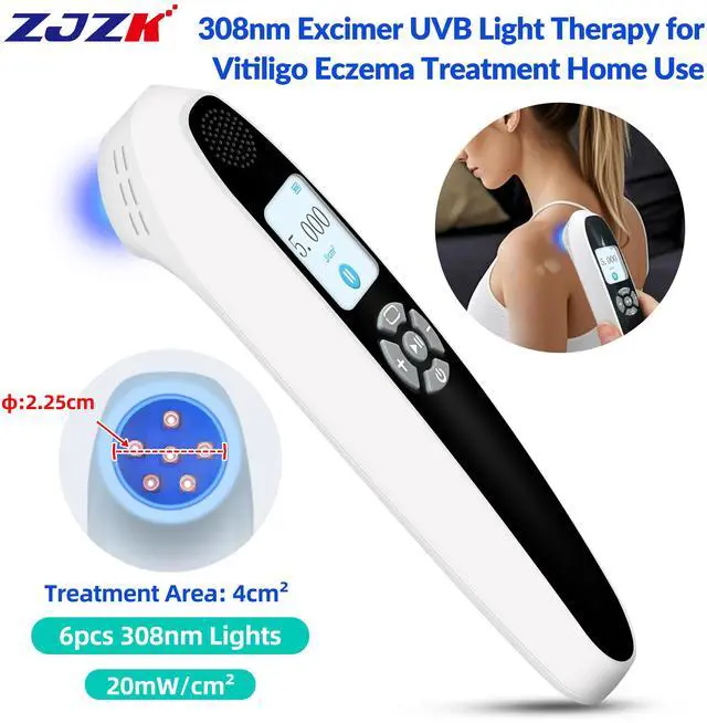 Main image of ZJZK Excimer 308nm Laser Ultraviolet Handheld 20mW/cm² for Vitiligo, psoriasis At-Home