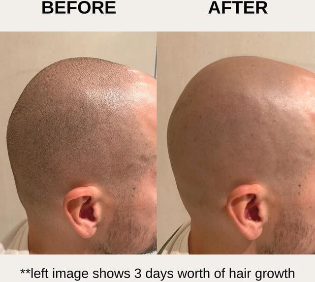 Alt view image 6 of 7 - The Bald Express Electric Head Shavers for Bald Men - The Bald Brothers - 5 in 1 Mens Cordless Grooming Kit | Electric Shaving for Bald Men | USB Charge | Skull Shaver for Men