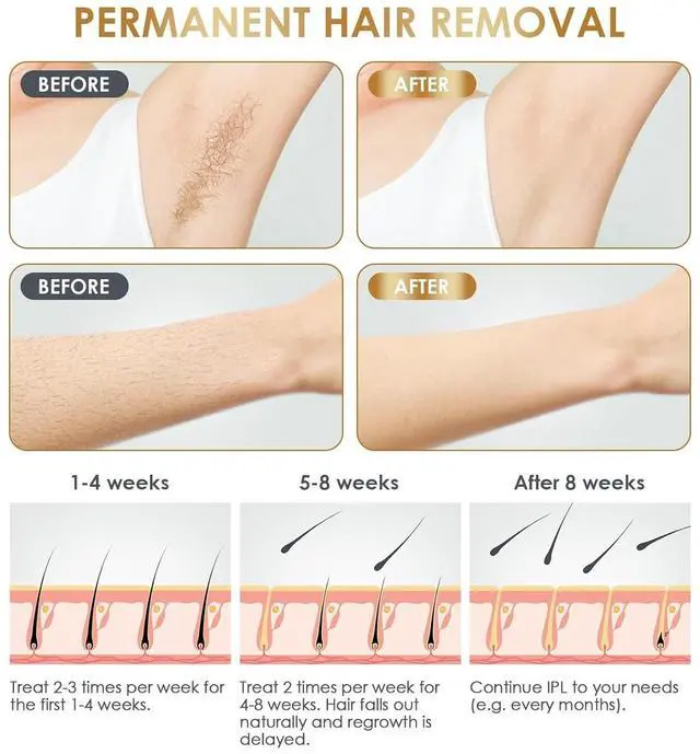 Alt view image 4 of 7 - IPL Laser Hair Removal Device at-Home for Women Men NATRSYM Painless Permanent Facial Upper Lip Bikini Line Armpits Back Legs Arms Face Back Whole Body Remover