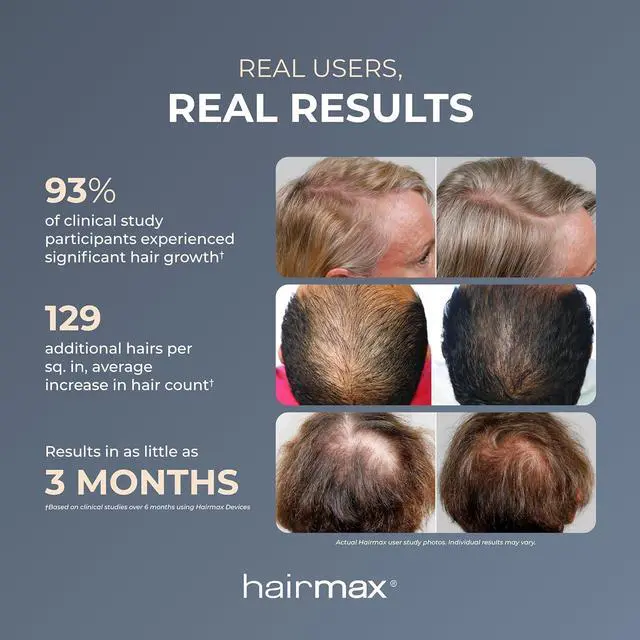 Alt view image 3 of 7 - Hairmax Ultima 12 LaserComb - (FDA Cleared) Laser Hair Regrowth Treatment Device for Men & Women - Reverses Thinning Hair Loss - Red Light Therapy to Stimulate Hair Growth - Cordless Design