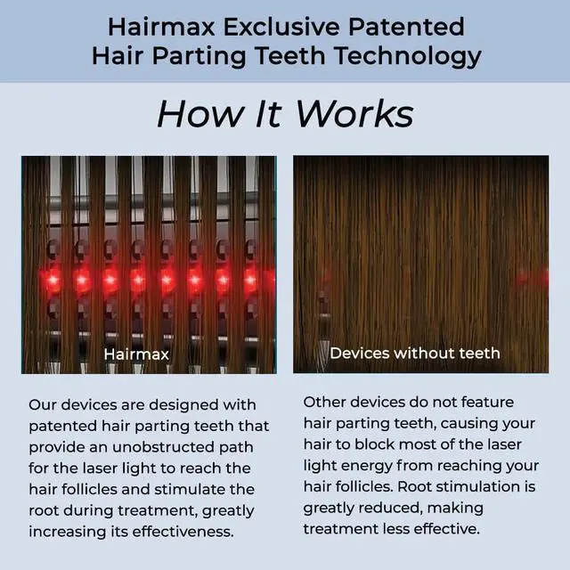 Alt view image 5 of 7 - Hairmax Ultima 12 LaserComb - (FDA Cleared) Laser Hair Regrowth Treatment Device for Men & Women - Reverses Thinning Hair Loss - Red Light Therapy to Stimulate Hair Growth - Cordless Design