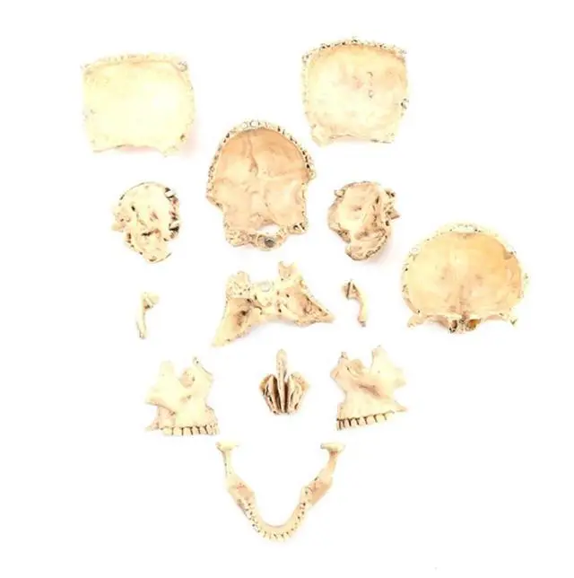 Main image of 1:2 Human Skull Model Teaching Study