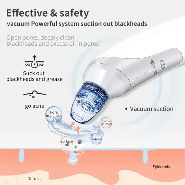 Alt view image 3 of 7 - Facial Pore Blackhead Remover - Face Cleaner and Blackhead Extractor with 4 Suction Heads