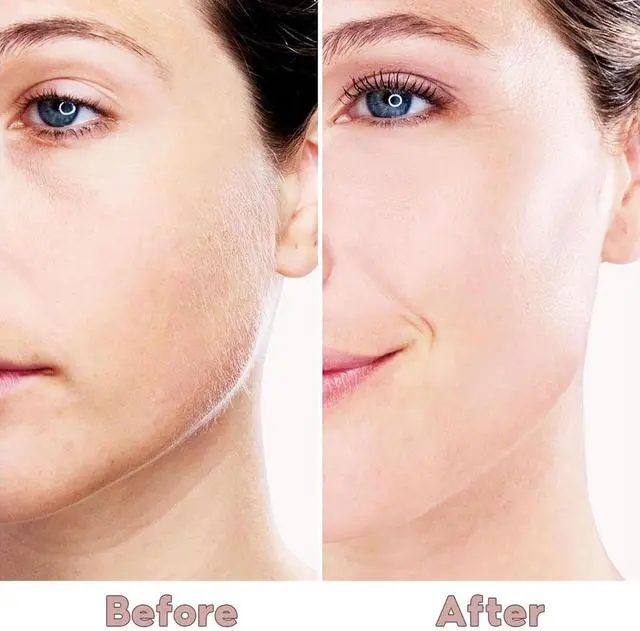 Alt view image 5 of 7 - YEVYO Facial Hair Remover for Women - Painless Electric Face Shaver with LED Light, USB Rechargeable Facial Hair Removal Tool for Lip Chin Cheeks - Rose Gold