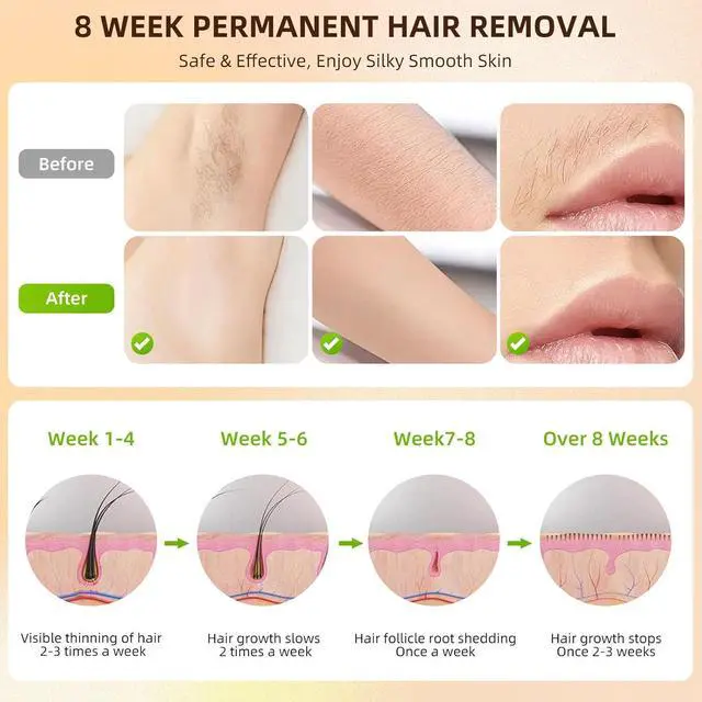 Alt view image 6 of 7 - YEVYO Laser IPL Hair Removal Device - Ice Cooling System & 6 Energy Levels for Women & Men - Permanent At Home Lazer Hair Removal for Body, Bikini, Armpit, Face - White