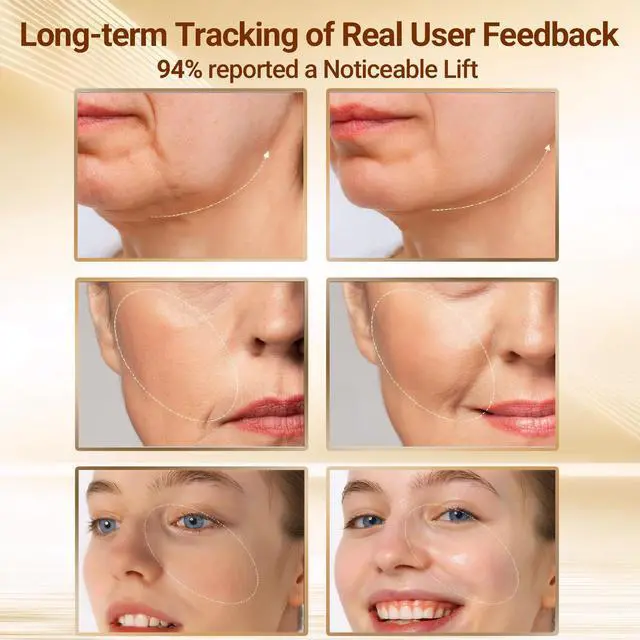 Alt view image 3 of 7 - YEVYO 7-in-1 RF Facial Massager Device - Microcurrent EMS Face Lifting Tool, LED Red Blue Light Therapy, Ionic Skin Cleanser - Skincare for Women at Home or Travel - Silver