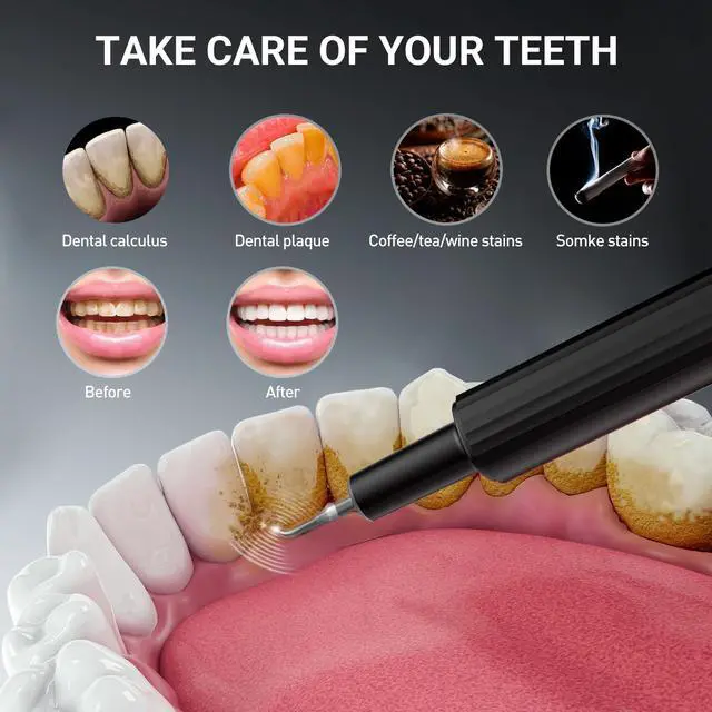 Alt view image 3 of 6 - YEVYO Plaque Remover for Teeth - Ultrasonic Tooth Cleaner with 4 Cleaning Modes & LED Display - Hard Tartar Remover Tool for Adults & Smokers - Black