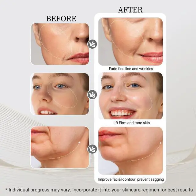 Alt view image 5 of 7 - YEVYO Radio Frequency Facial Device - EMS Face Lift Massager Tool with Red Blue Light for Wrinkle Removal and Lifting - for Women Home Use - Silver Gray