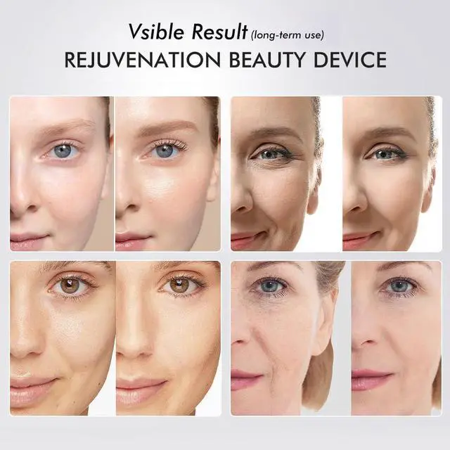 Alt view image 2 of 7 - _Mega Brand Skin Tightening Face Machine, Face Massager Tool with 5 Modes, Enhanced Absorption, Facial Neck Lifting, Firming and Pore Care