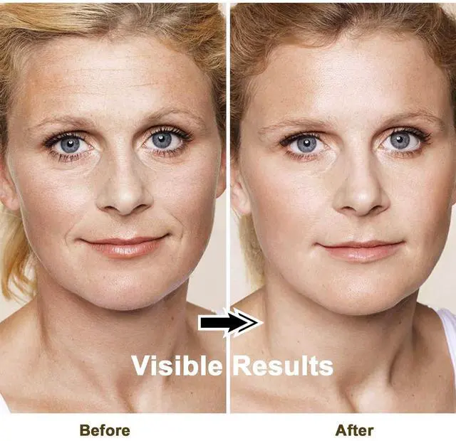 Alt view image 6 of 6 - _Mega Brand Face Skin Tightening Machine - Radio Frequency Anti-Aging Device Microcurrent Face Massager Lifting, Firming, Toning, Wrinkles Reduction De-Puffiness for Facial and Neck