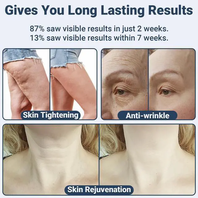 Alt view image 5 of 6 - _Mega Brand Radio Frequency Skin Tightening - _Mega Brand RF Radiofrecuencia Facial Skin Machine for Face and Full Body - with 3 Energy Levels & Timer