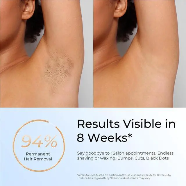 Alt view image 2 of 7 - Laser Hair Removal, IPL Laser Hair Removal for Women and Men Permanent, Hair Removal Device with 3.0 IPL Red Light Wave, Home Laser Hair Removal Device for Facial Legs Armpits Bikini Body Use