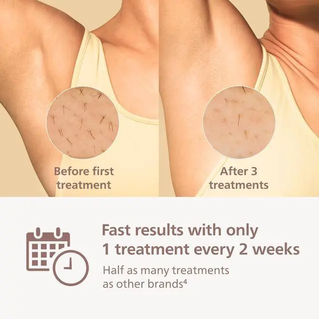 Alt view image 4 of 7 - _Mega Brand Lumea 8000 Series IPL Hair Removal Device - Alternative to Laser Hair Removal, SenseIQ Technology and Lumea App, 3 Attachments for Body, Face, and Precision, for Women & Men, BRI937/03