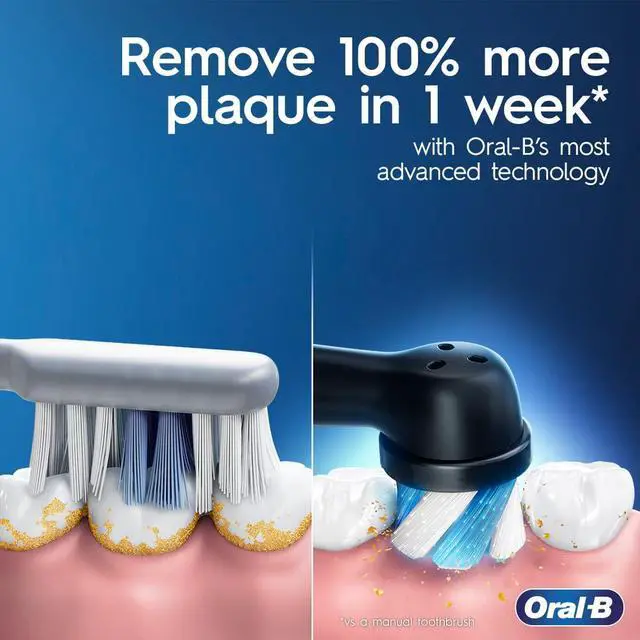 Alt view image 3 of 7 - _Mega Brand Rechargeable Electric Powered Toothbrush, Black with iO Series 3 Limited, 2 Brush Heads and Travel Case - Pressure Sensor to Protect Gums - 3 Cleaning Settings - 2 Minute Timer