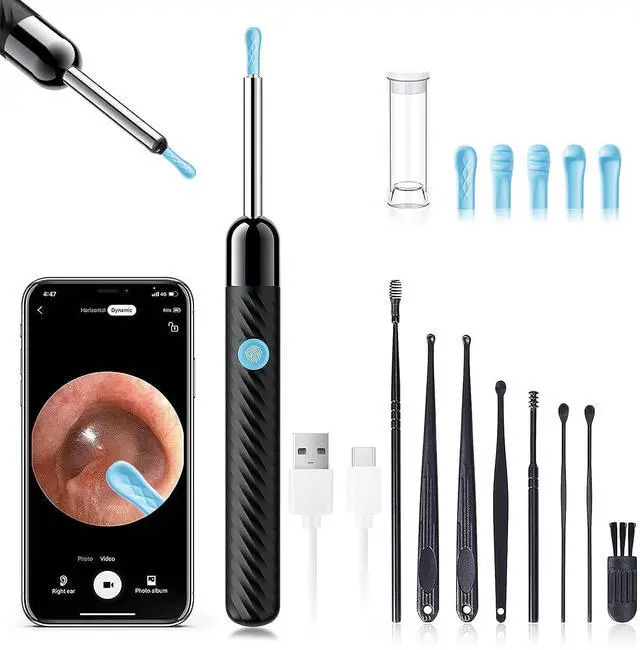 Main image of _Mega Brand Ear Wax Removal - Earwax Remover Tool with 8 Pcs Ear Set - Ear Canal Cleaner with 1080P Camera - FSA HSA Eligible - Ear Cleaning Kit with 6 Ear Spoon - Ear Camera for iOS & Android (Black)