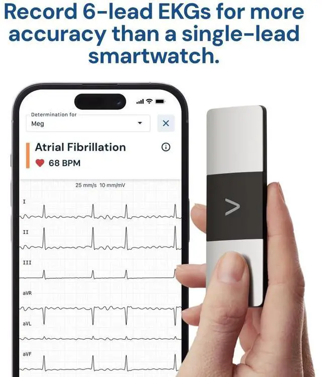 Alt view image 2 of 6 - _Mega Brand KardiaMobile 6-Lead Personal EKG Monitor Six Views of The Heart Detects AFib and Irregular Arrhythmias Instant Results in 30 Seconds Works with Most Smartphones