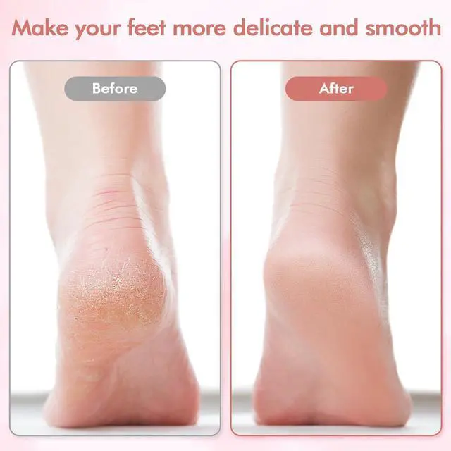 Alt view image 3 of 7 - Electric Foot File and Callus Remover,Professional Pedicure Tools for Dry, Calluses, Dead, Cracked, Hard Skin,Equipped with 2 Grinding Heads and 1 Cleaning Brush